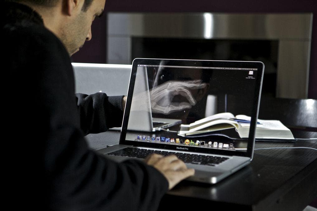 The Scanners Don't Actually Expose You To Much Radiation