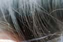 Head Lice Only Prefer Dirty And/Or Long Hair on Random Untrue Myths About Animals
