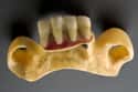Wearing Dentures Made From Cadaver-Teeth on Random Weirdest Bits Of Victorian Etiquette You Won't Believe People Actually Observed