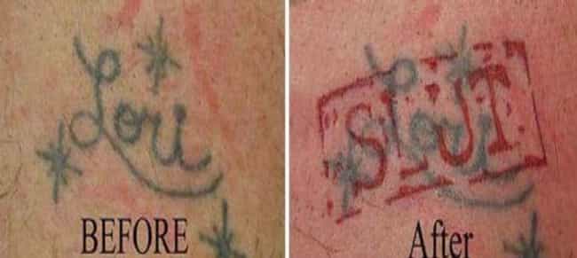 What's Worse Than A Tramp Stamp? Behold.