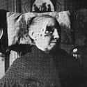 Radium Emanation Bath Salts Cured Insomnia on Random Horrific 20th Century Quack Medical Devices That Contained Radium