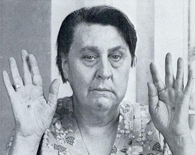 Стигматы это простыми словами. Стигматы это простыми словами. Стигматы иисуса христа. Стигматы это простыми словами. Стигматы это простыми словами.