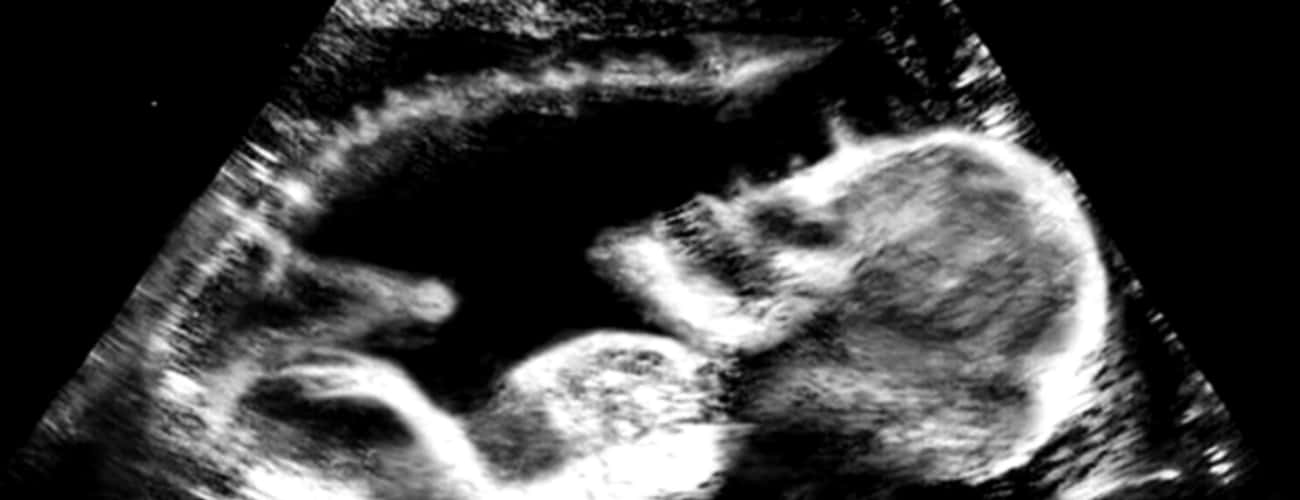 Your Ultrasound Reveals A Spooky Fetus