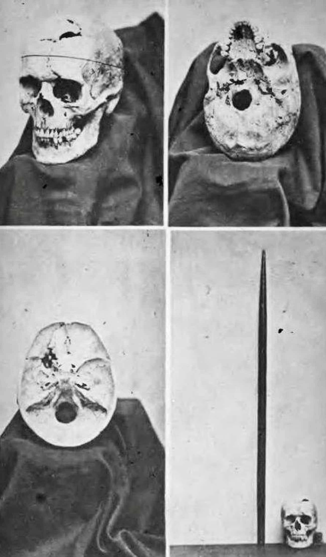 Famous Neuroscience Patient Phineas Gage Is Buried There