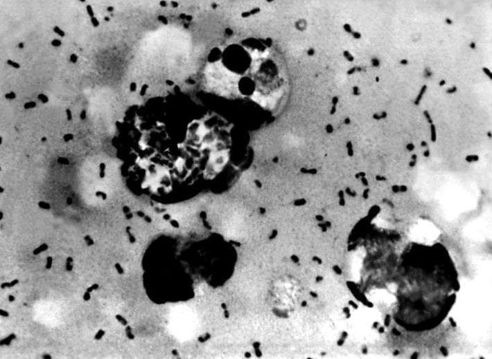 The Horrifying And Lethal Experiments Of Unit 731