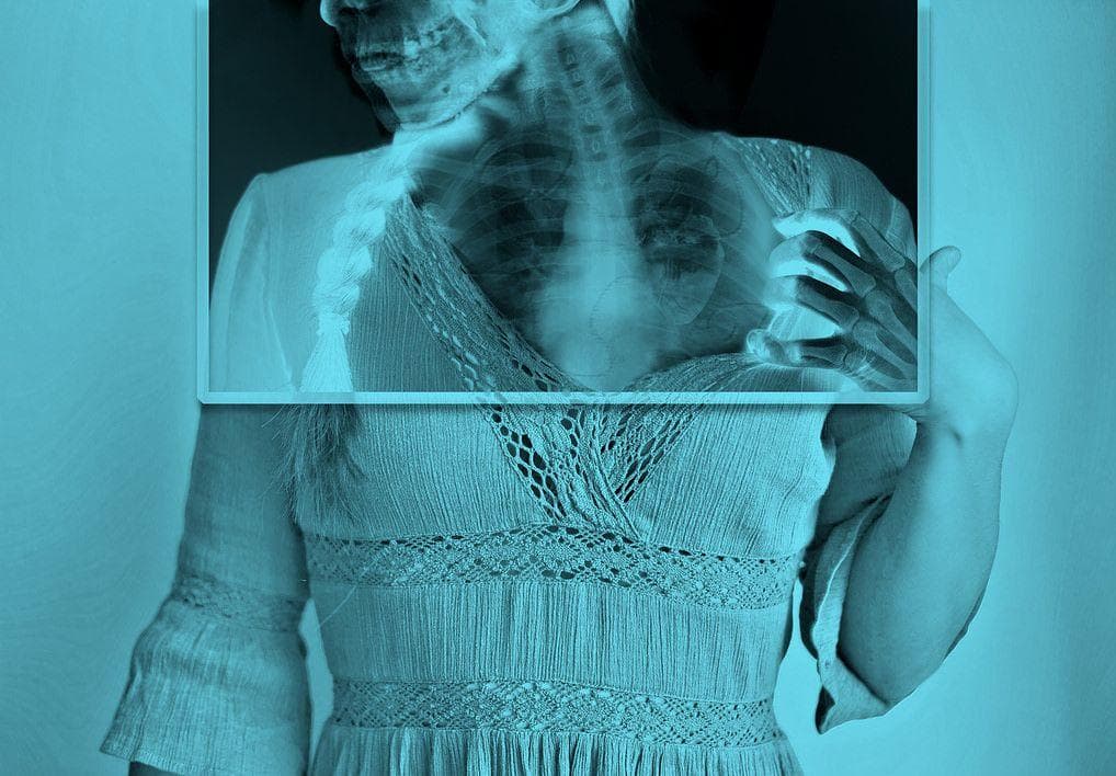 Sugary Drinks Like Fruit Juice Are Linked To Heart Disease