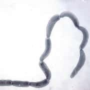 A Tapeworm That Lives In Somebody’s Digestive System