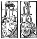 The Idea For Lobotomy Stemmed From The Practice of Trepanning on Random Things About Early Lobotomy, Surgeons Would Literally Pour Alcohol Onto Their Patients' Brains