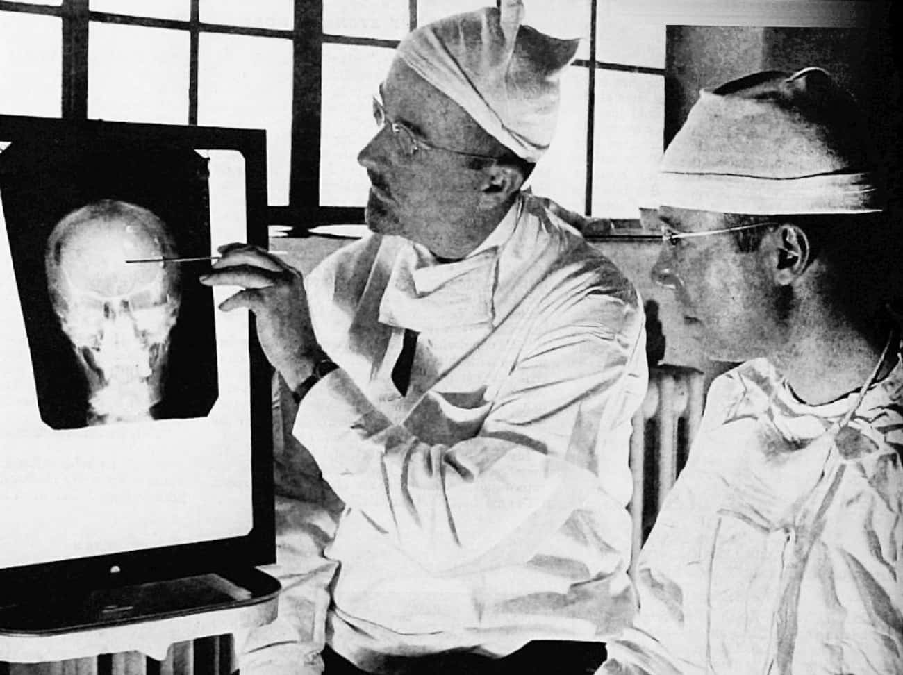 Gottlieb Burkhardt Removed Parts Of Schizophrenic Patient&#39;s Brains In The 1890s