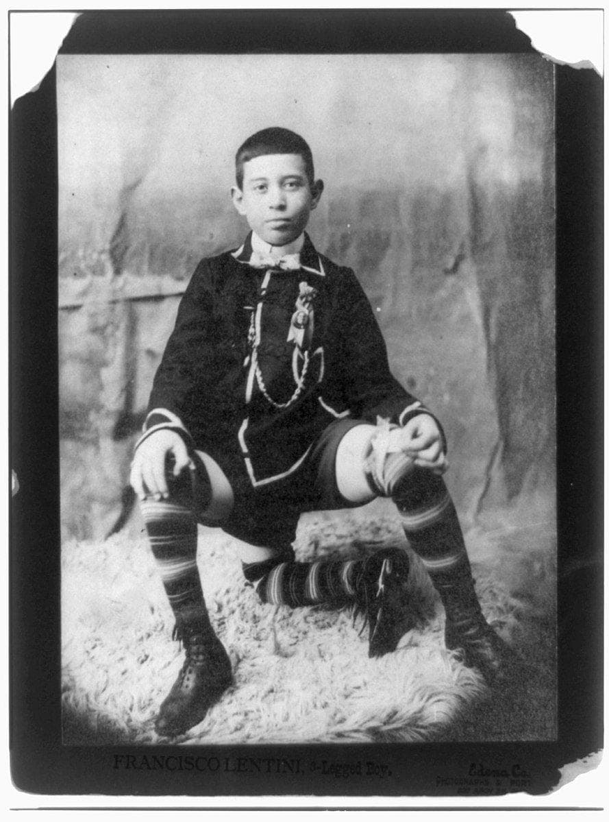 Франческо лентини. Американец фрэнк лентини. Франческо лентини. Франческо лентини в цирке. Папа 3 ноги.