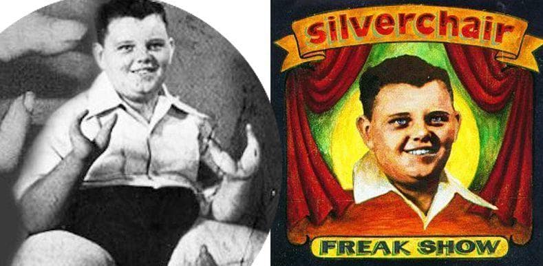 Meet Grady Stiles, The Murderous Lobster Boy Who Killed His Daughter's