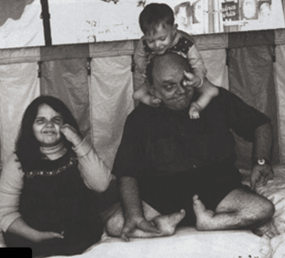 Meet Grady Stiles, The Murderous Lobster Boy Who Killed His Daughter's