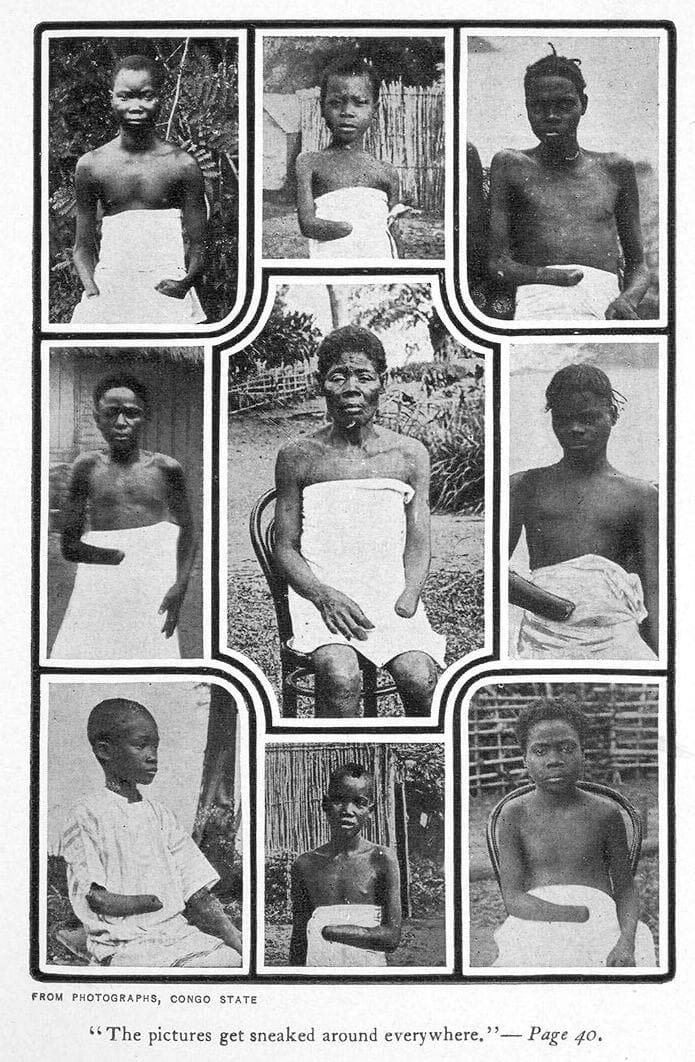 Atrocities The Belgians Committed In The Congo The World Tried To