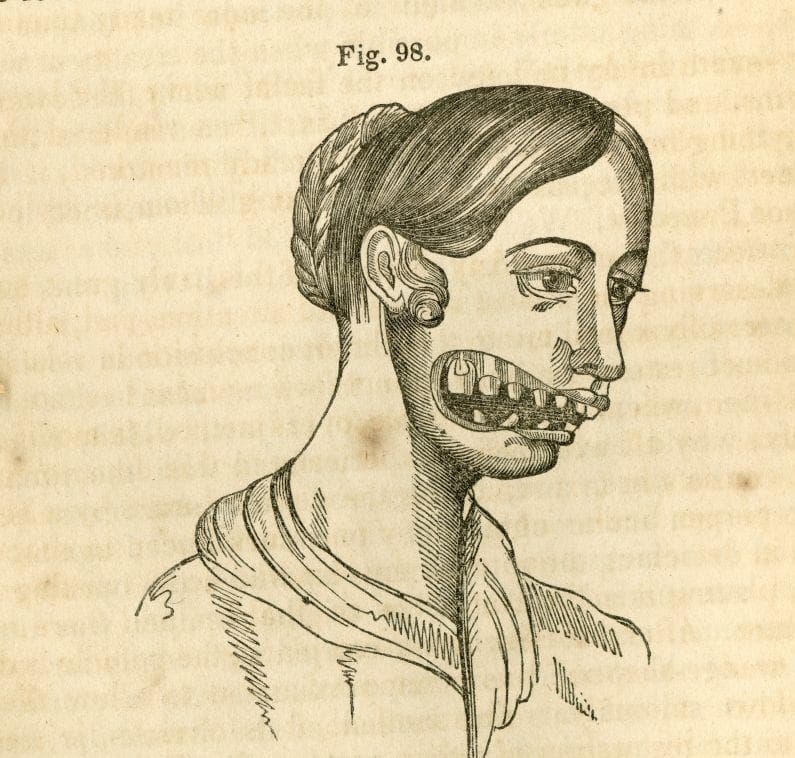 Eben Byers — The Man Who Drank Radioactive Water Until, 45 OFF