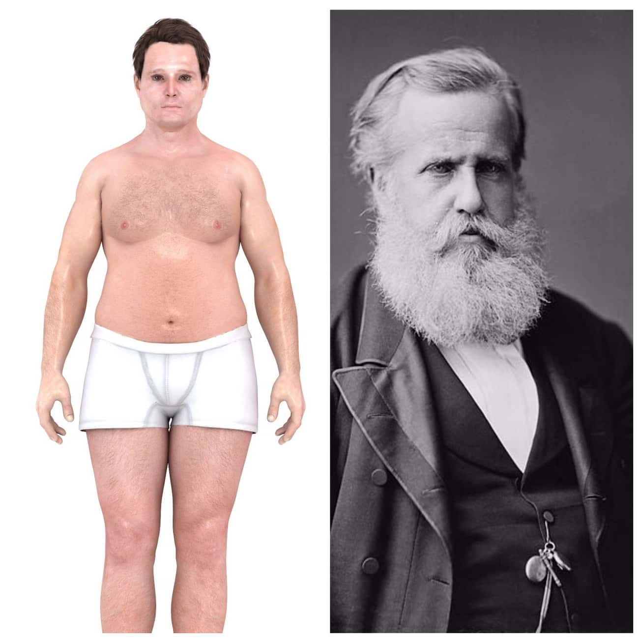 1870s: Heavyset Bodies Signified Wealth