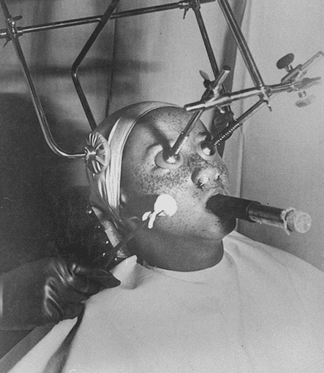 A "Freckle Removing Device... is listed (or ranked) 2 on the list Ways To Make People "Beautiful" That Seem A Bit Extreme