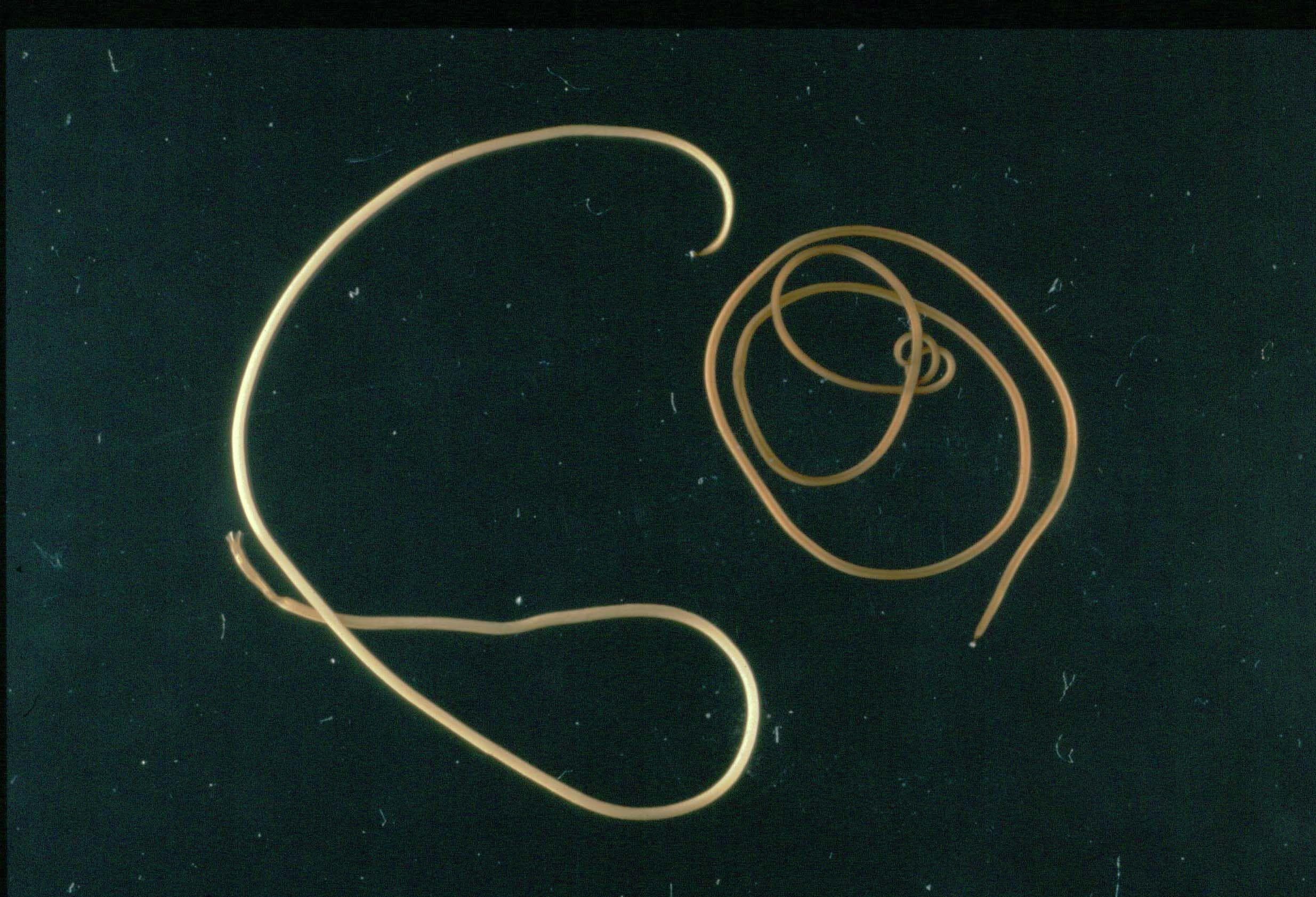 Horsehair Worms Are Real, Horrifying Parasites... And They've Evolved