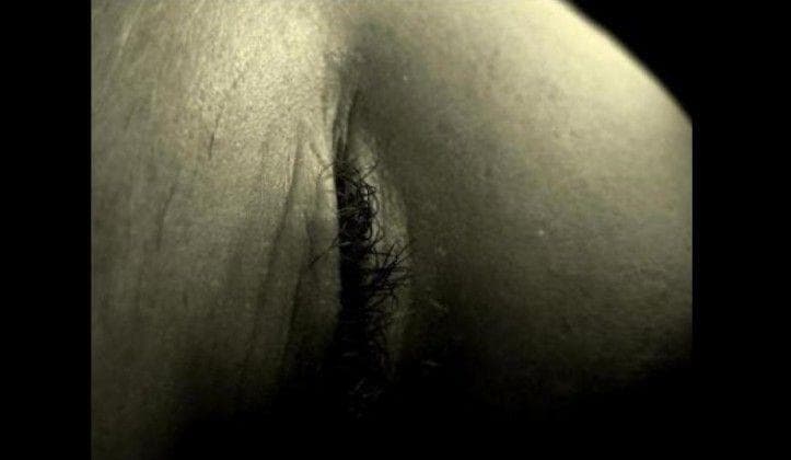 Sometimes Eyelids Can Look Like... Other Things