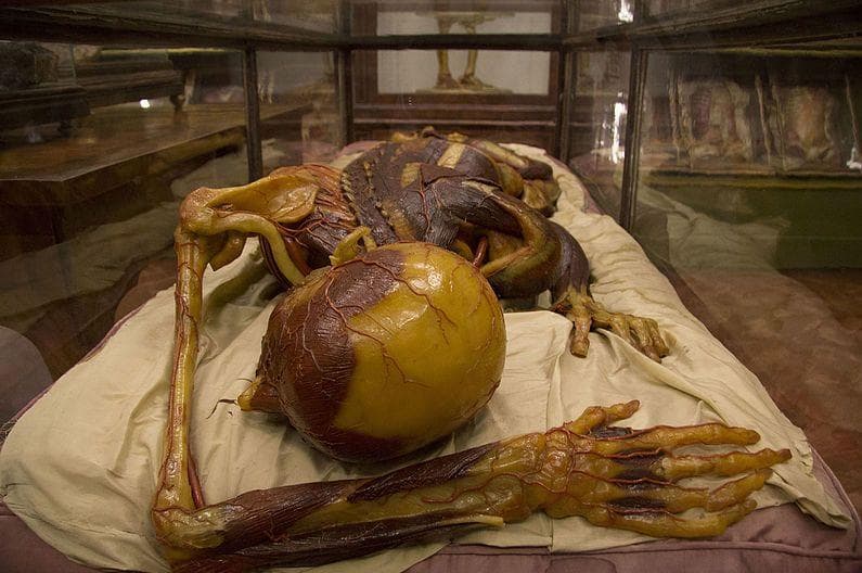 These Grotesque 18th Century Wax Models Were Made From Real Cadavers