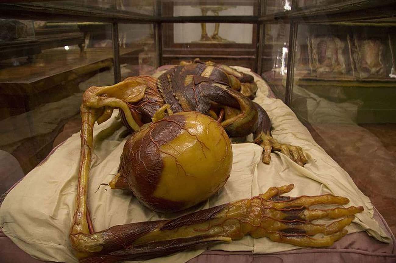 There Was A Body Shortage In 18th Century Medical Schools, So Wax Models Were The Next Best Thing