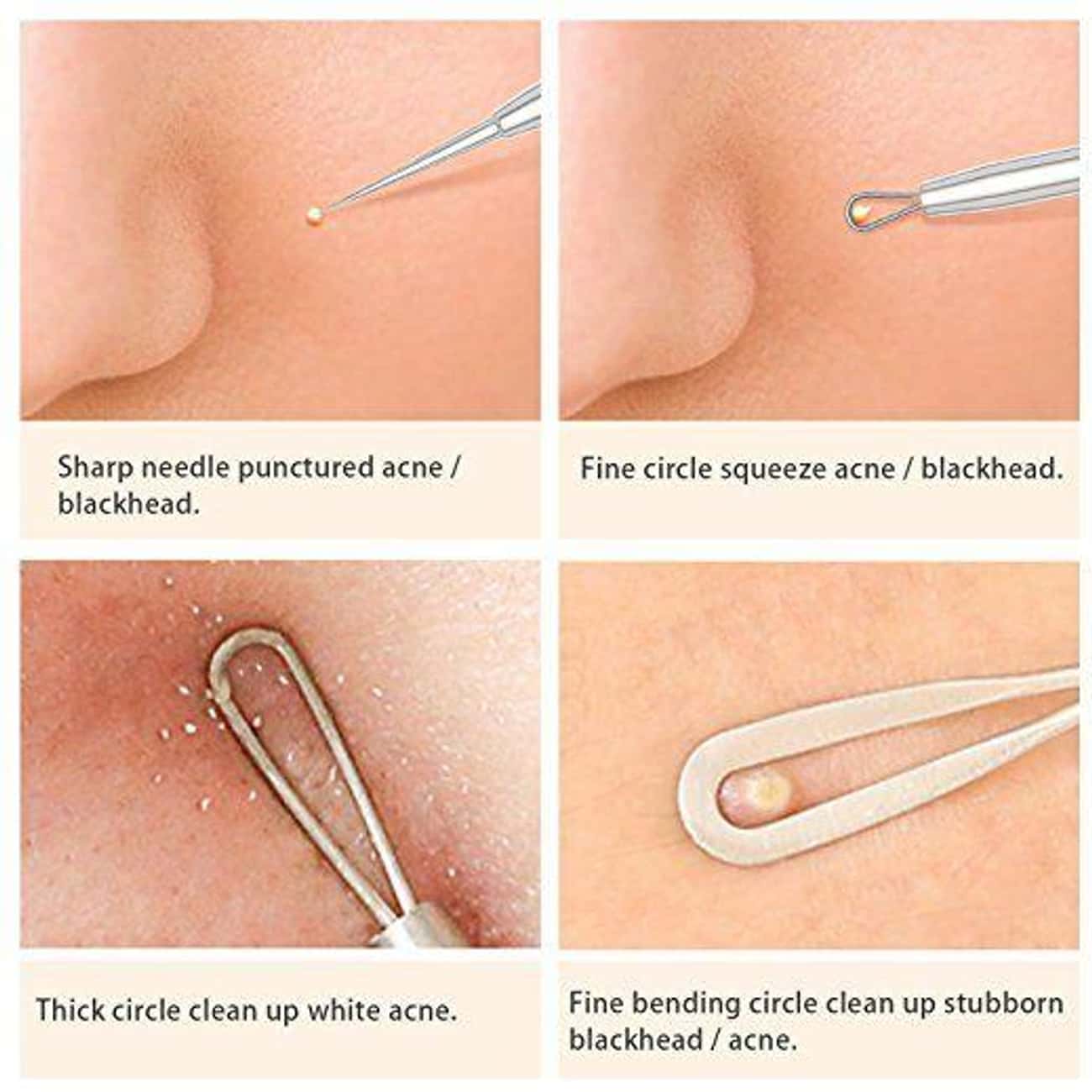 This Creepy But Effective Zit Destroyer