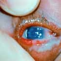 Your Eyes Get Goopy on Random Disgusting And Creepy Things That Happen To Your Body While You're Sleeping