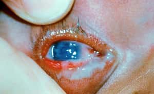 Your Eyes Get Goopy is listed (or ranked) 3 on the list Disgusting And Creepy Things That Happen To Your Body While You're Sleeping