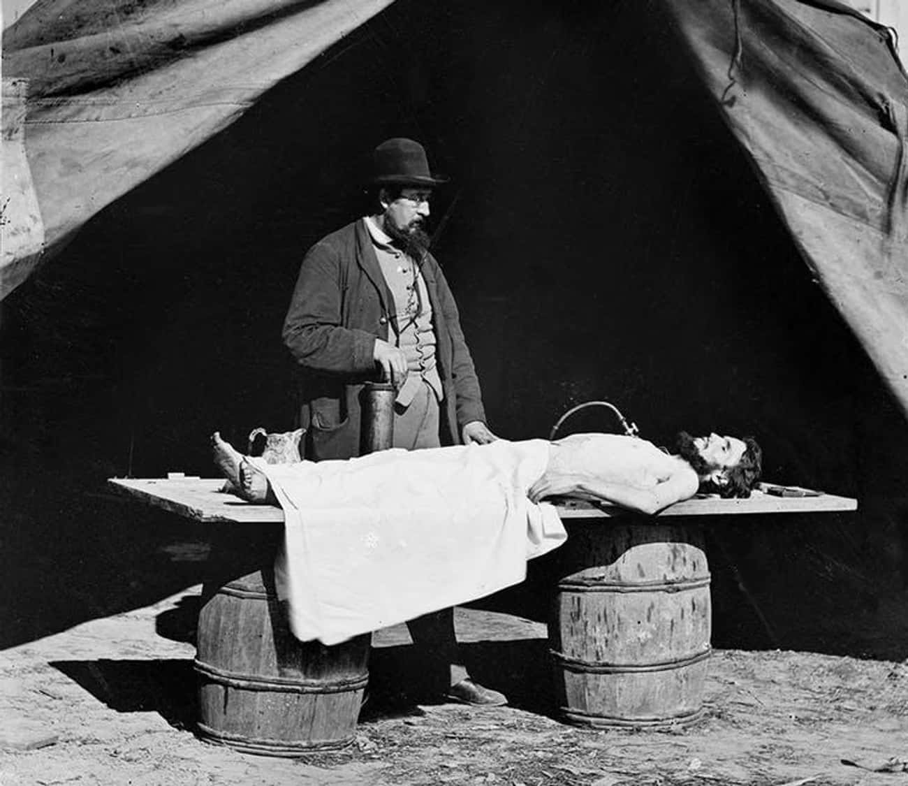 The Civil War Was Big Business For Embalmers