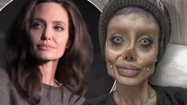 Remember Angelina Jolie Fan with 50 Surgical Procedures To Look Like ...