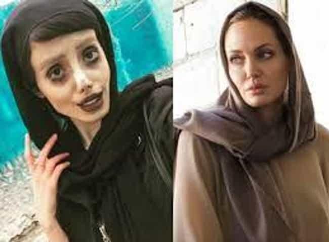 Remember Angelina Jolie Fan with 50 Surgical Procedures To Look Like ...