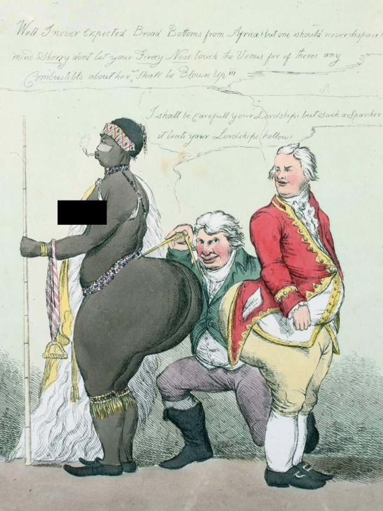Baartman's Unusually Large Backside Stemmed From A Medical Condition