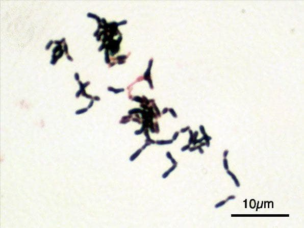 People With Type B Blood Are Swarming With Good Bacteria