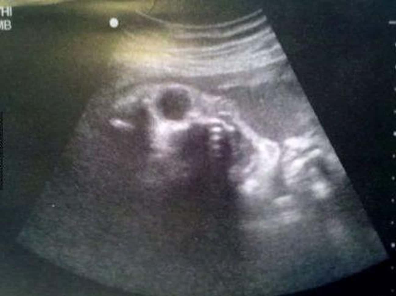 фото ребенка в животе 19 недель
