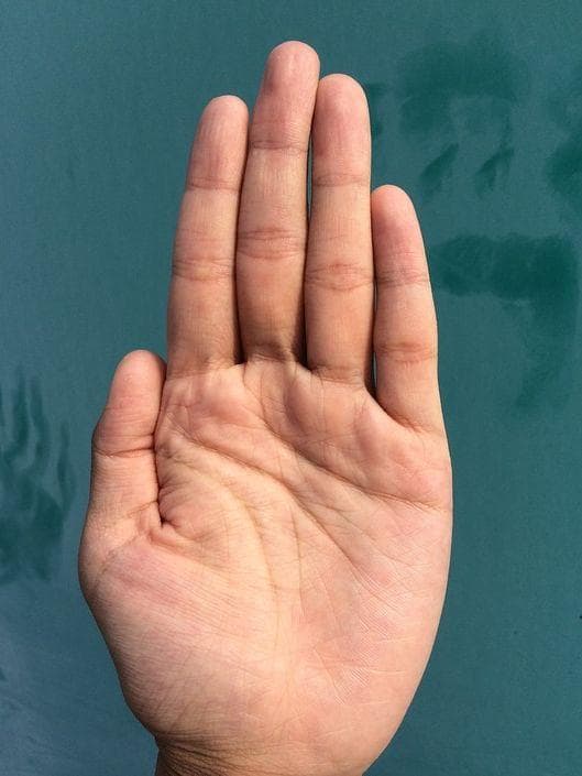 Here Are All The Things You Really Don't Want To See On Your Hand