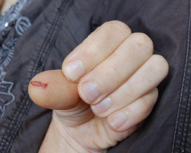 Here Is The Real Reason Why Paper Cuts Hurt So Badly