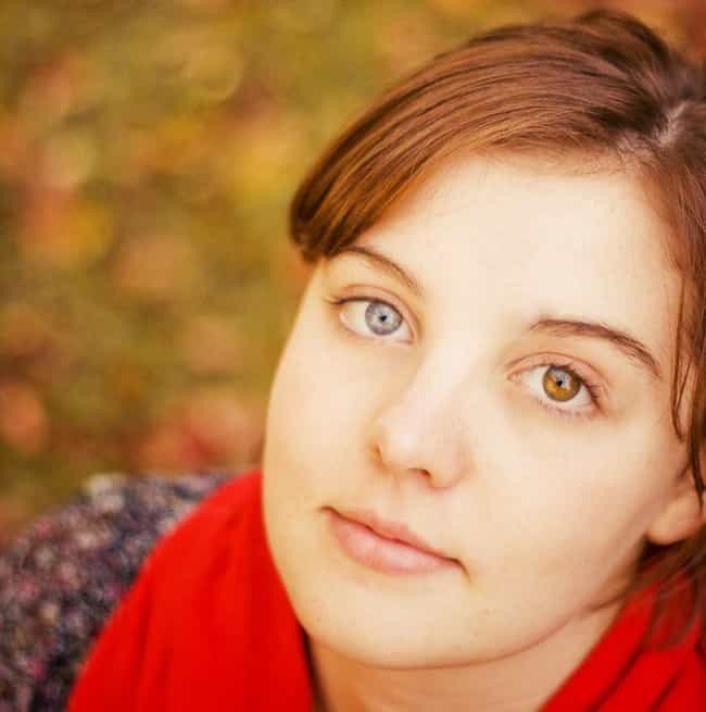 Image result for heterochromia