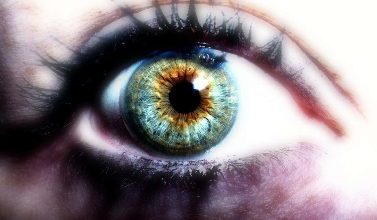 Heterochromia Is Closely Linked To Melanin Distribution