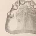 The Market For Human Teeth Preyed On Poor People on Random Things Of George Washington's Teeth Weren't Wooden At All - They May Have Been Teeth of Slaves