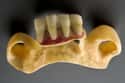 The Tooth Transplants Could Transmit STDs on Random Things Of George Washington's Teeth Weren't Wooden At All - They May Have Been Teeth of Slaves