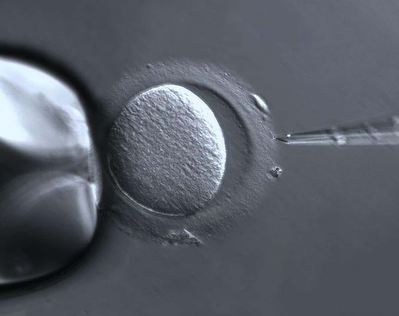People Doubted IVF Babies Would Be Able To Conceive As Adults