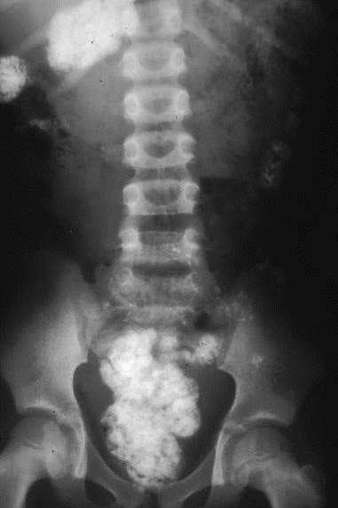 Here Is Everything You Need To Know If You Ever Find Yourself Coughing