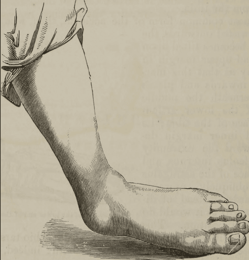 Here Are The 16 Most Painful Injuries Someone Can Experience