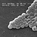 Multidrug-Resistant Acinetobacter on Random Most Dangerous Drug-Resistant Diseases
