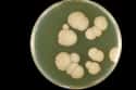 Fluconazole-Resistant Candida Fungi on Random Most Dangerous Drug-Resistant Diseases