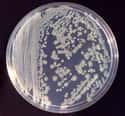 Extended Spectrum Enterobacteriaceae on Random Most Dangerous Drug-Resistant Diseases