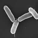 Drug-Resistant Salmonella Serotype Typhi on Random Most Dangerous Drug-Resistant Diseases