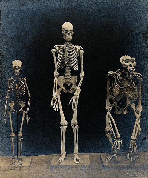 Human Bones Or Animal Bones? Here's How You Can Tell The Difference