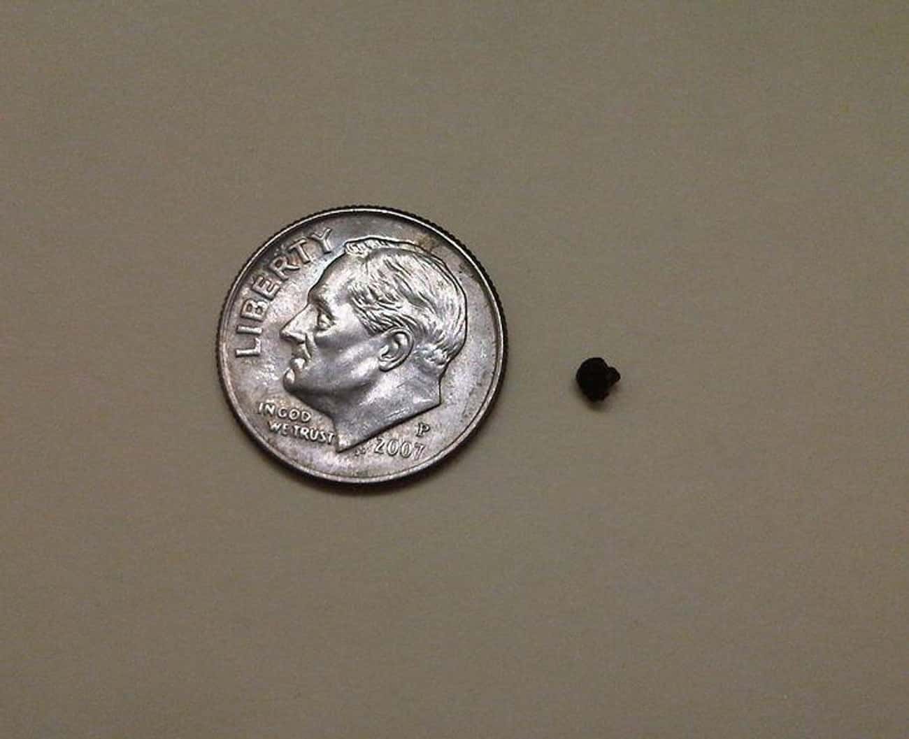 You May Have Small Kidney Stones Right Now