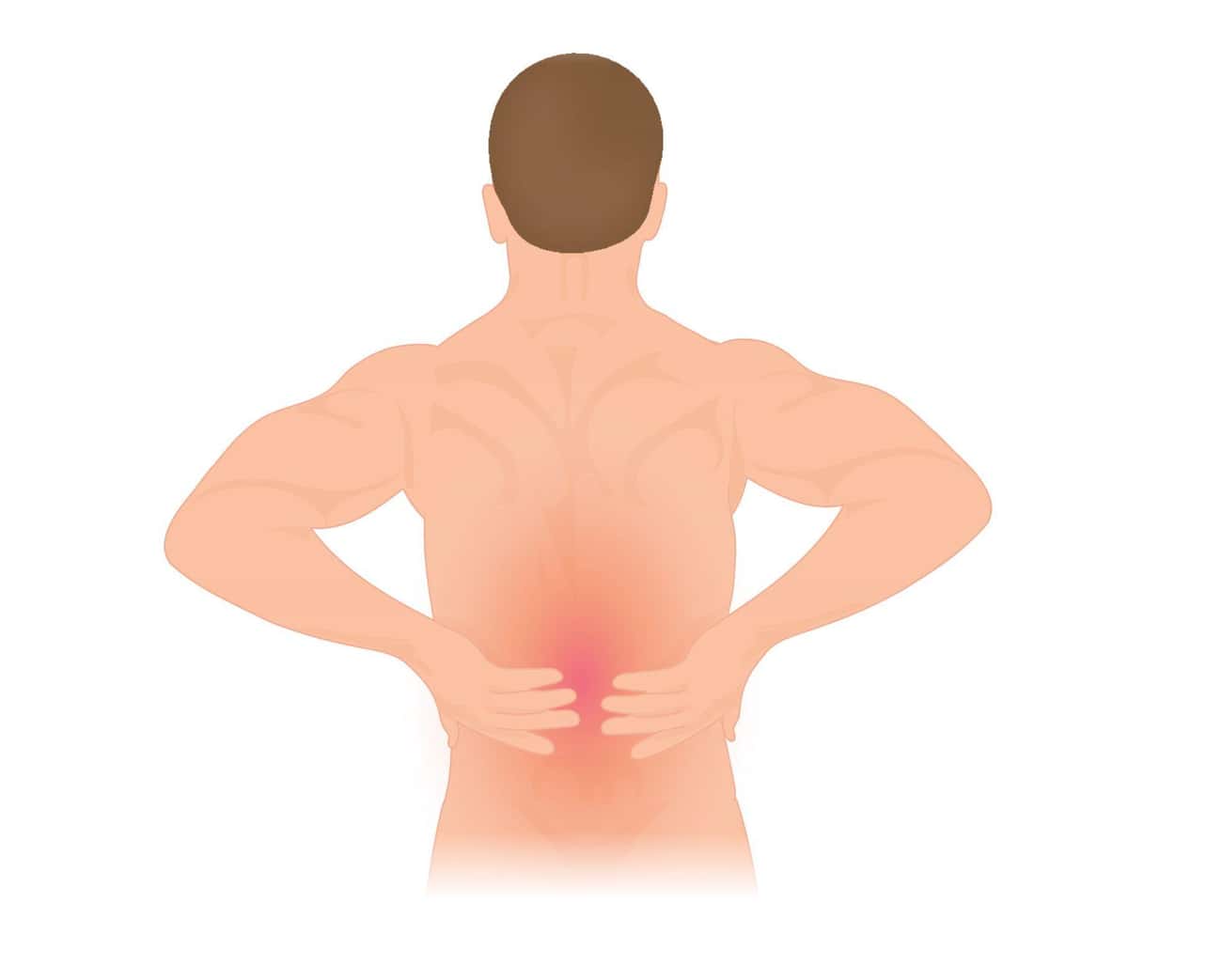 Severe Back Pain Can Be An Initial Symptom Of A Kidney Stone