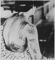 Skin Burned In A Pattern Corresponding To The Dark Portions Of A Kimono Worn At The Time Of The Explosion on Random Most Haunting Photos Of Hiroshima, Taken In The Aftermath Of The Atomic Bomb